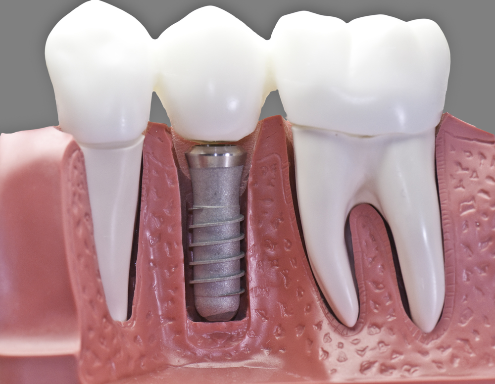 Where can I find Endodontics in Kendall?